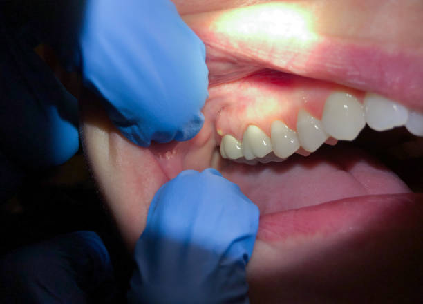 Best Cosmetic Emergency Dentistry in Osprey, FL