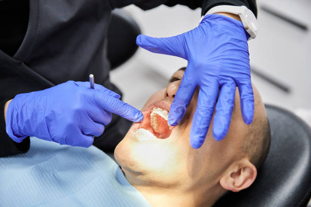 Best Emergency Gum Treatment in Osprey, FL